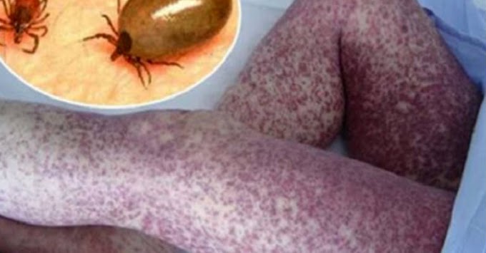 BE ALERT: If You Sleep With Your Pet, Your Health And Your Kid’s Health Are In Danger! Here’s Why….
